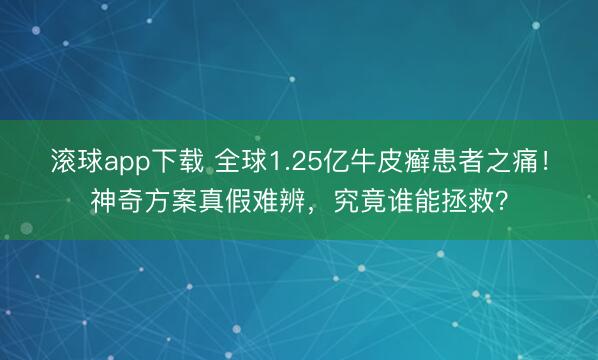 滚球app下载 全球1.25亿牛皮癣患者之痛！神奇方案真假难辨，究竟谁能拯救？