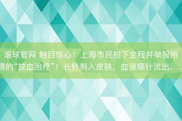 滚球官网 触目惊心!上海市民拍下全程并举报所谓的“放血治疗”!长针刺入皮肤,血液顺针流出……